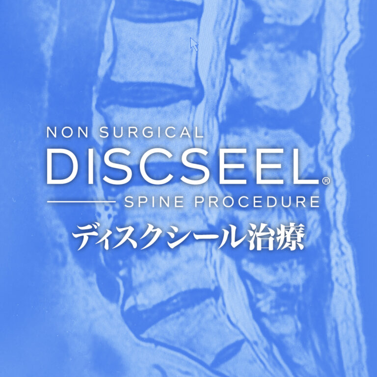腰痛とサヨナラ（脊柱管狭窄症・60代男性）