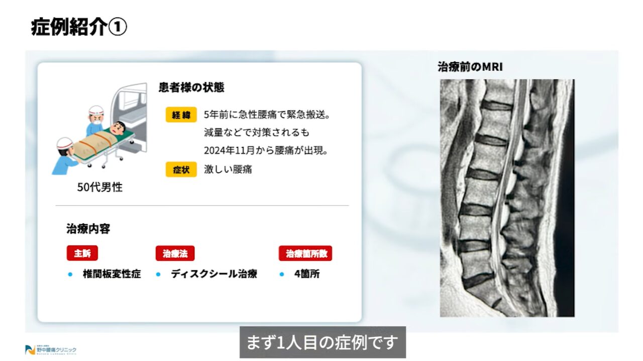 症例①患者様の状態