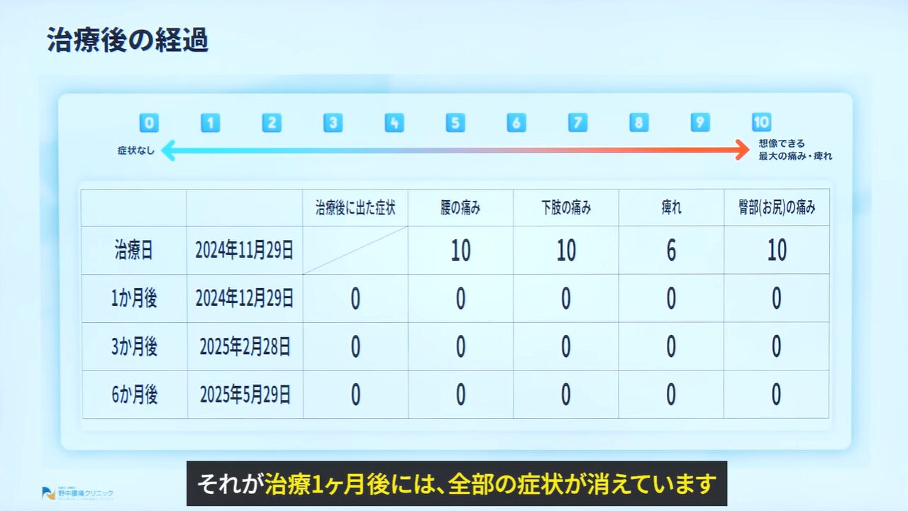 症例①造影検査の様子