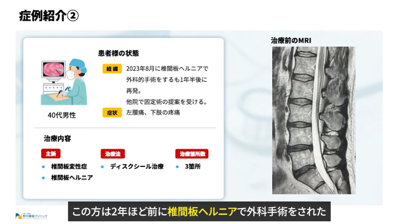 症例②患者様の状態