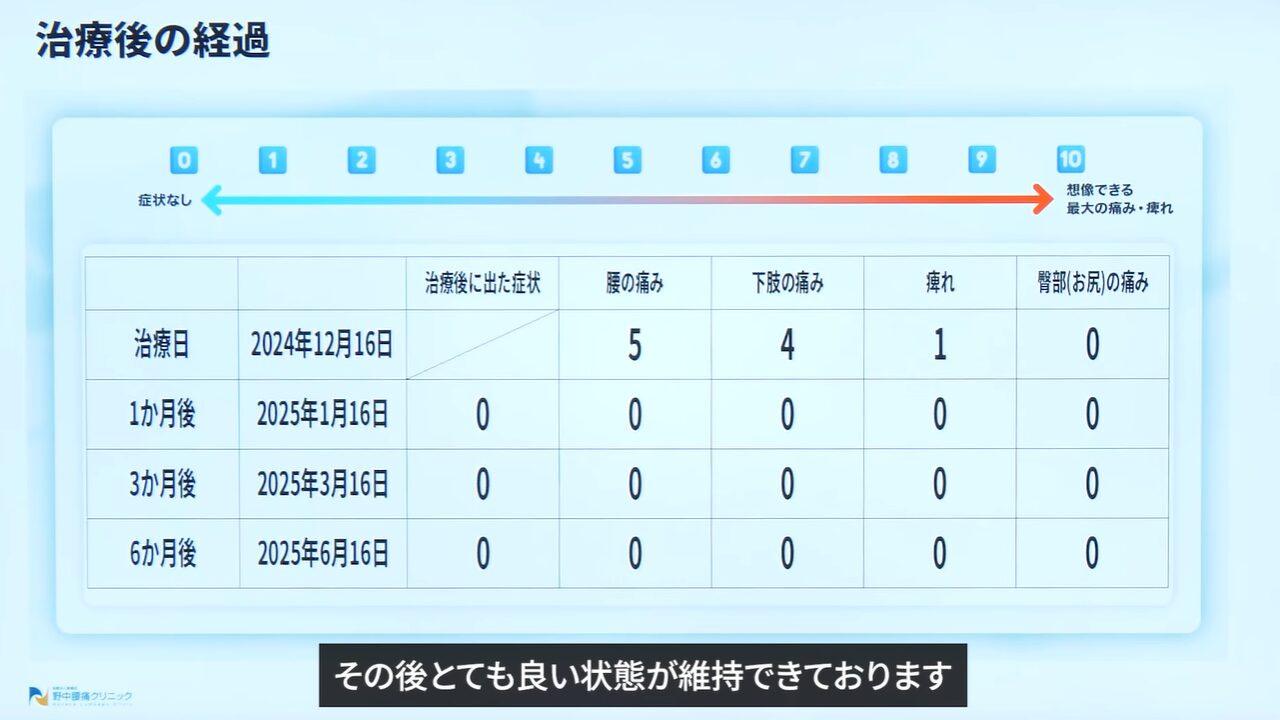 症例②造影検査の様子