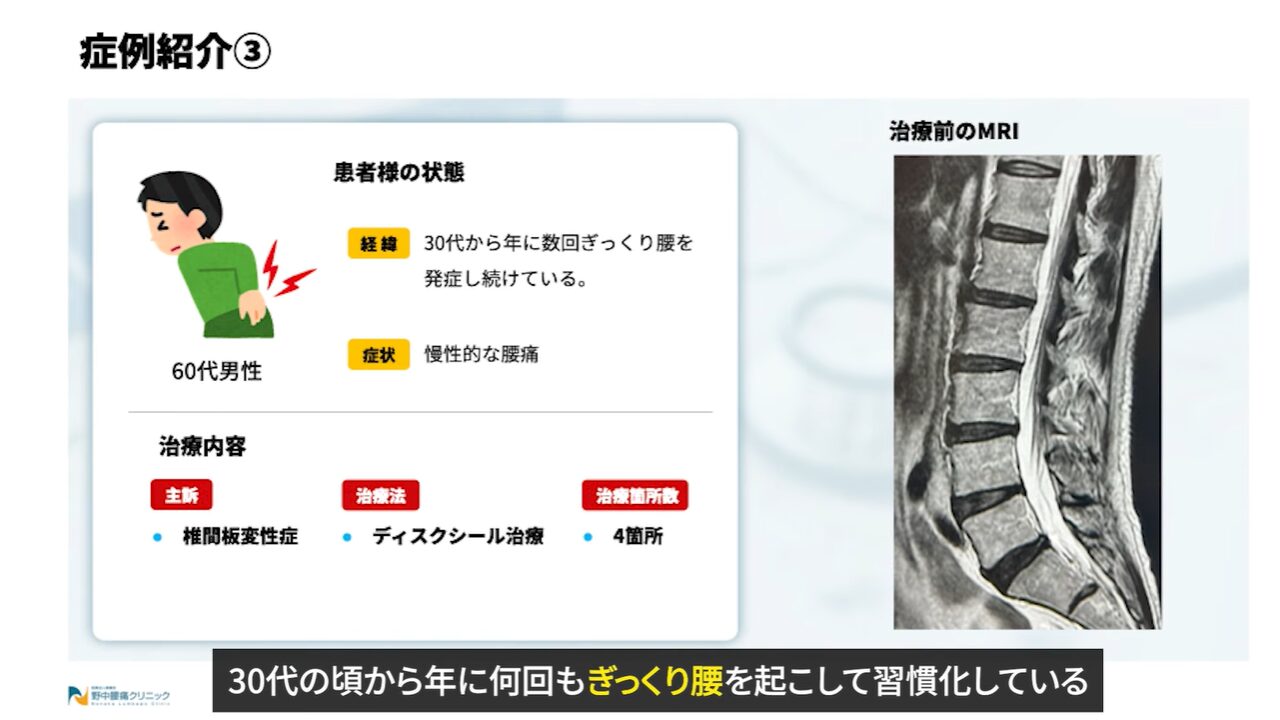 症例③患者様の状態