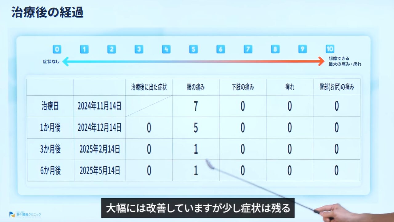 症例③造影検査の様子