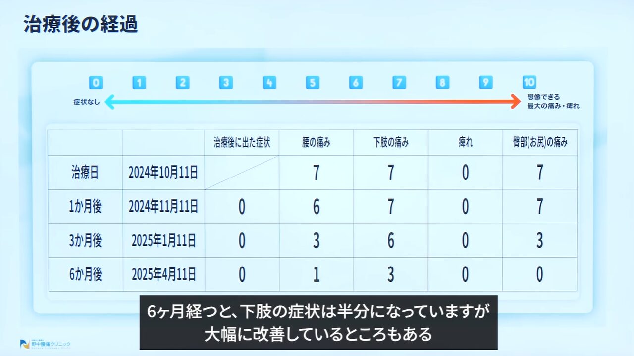 症例④造影検査の様子