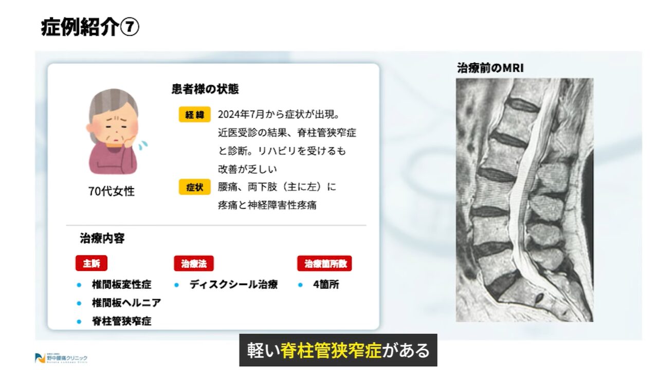 症例⑦患者様の状態