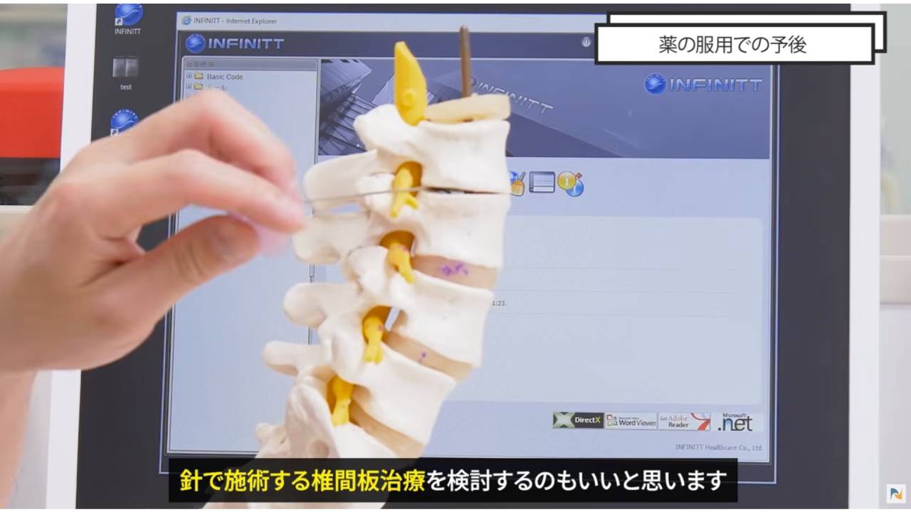 画像は脊柱管狭窄症の注意点の画像