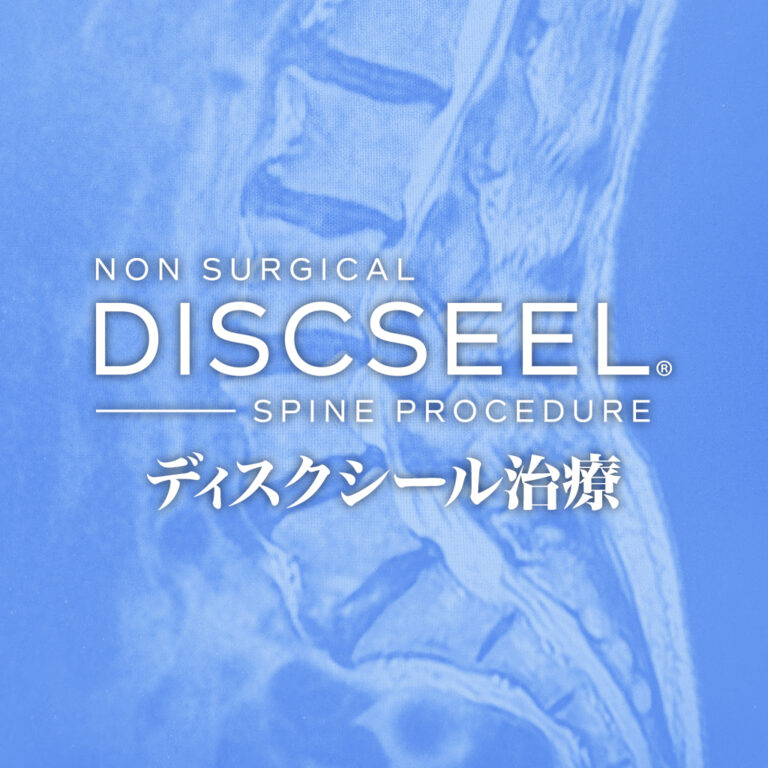 椎間板が家出（80代女性）