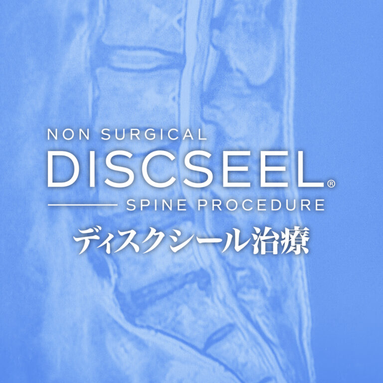 腰痛が再燃（40代男性）