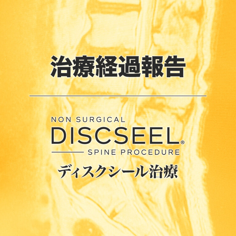 脊柱管狭窄症に対しての治療から1年が経過した50代男性