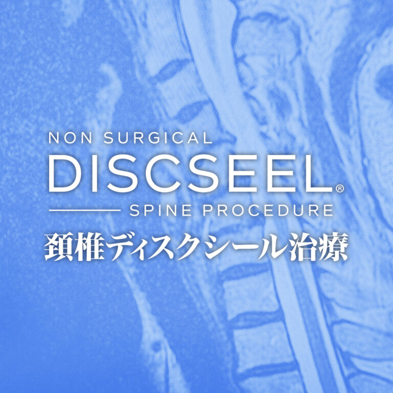 頚部痛と慢性肩こりの50代女性