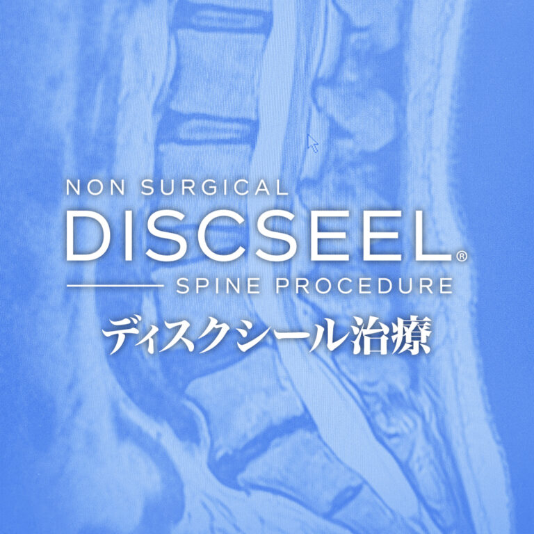 ぎっくり腰を繰り返す50代男性