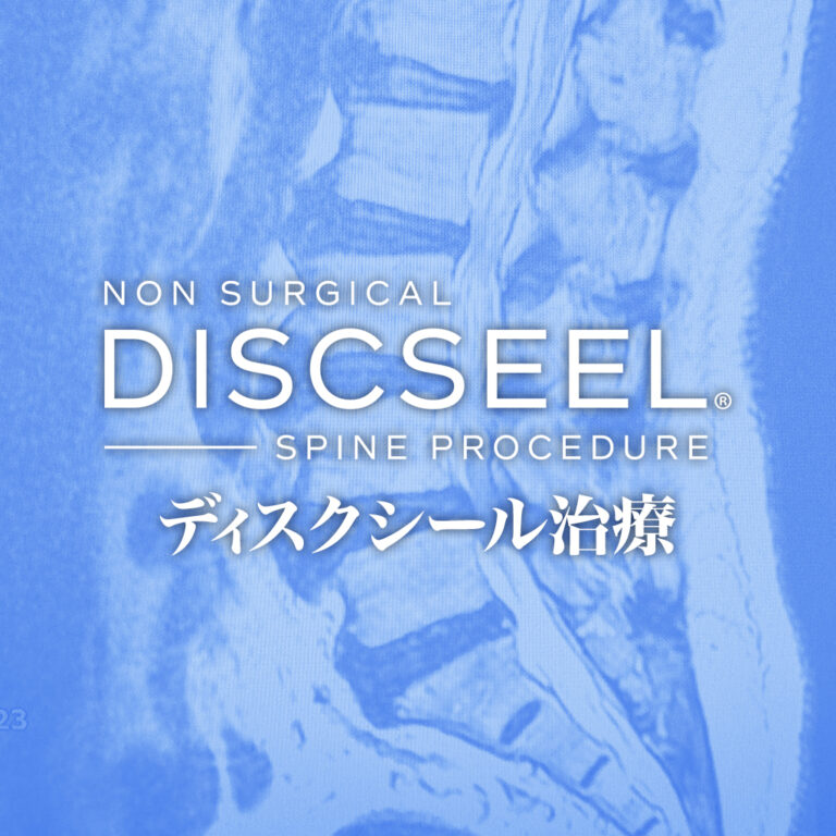 シンガポールから来日の70代男性