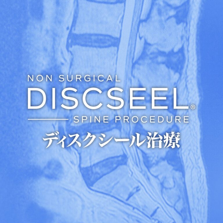 検査では異常なしと言われた「腰痛」