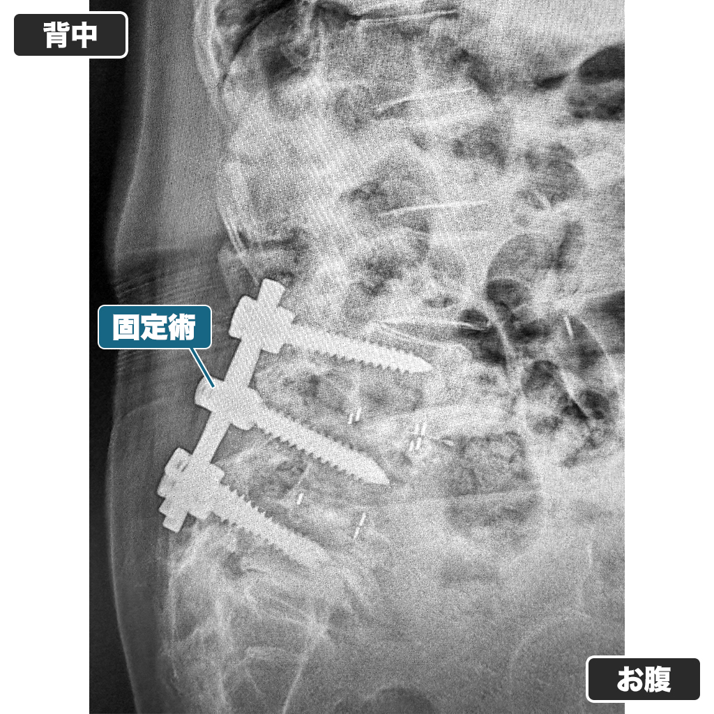 レントゲン検査