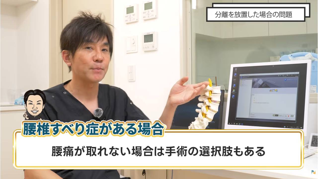 画像は外科手術の説明