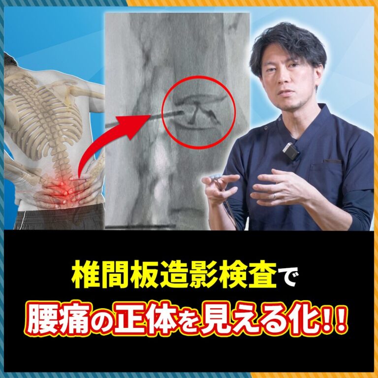 椎間板ヘルニアが治らない原因は「穴」？椎間板造影検査の真実と最新腰痛治療