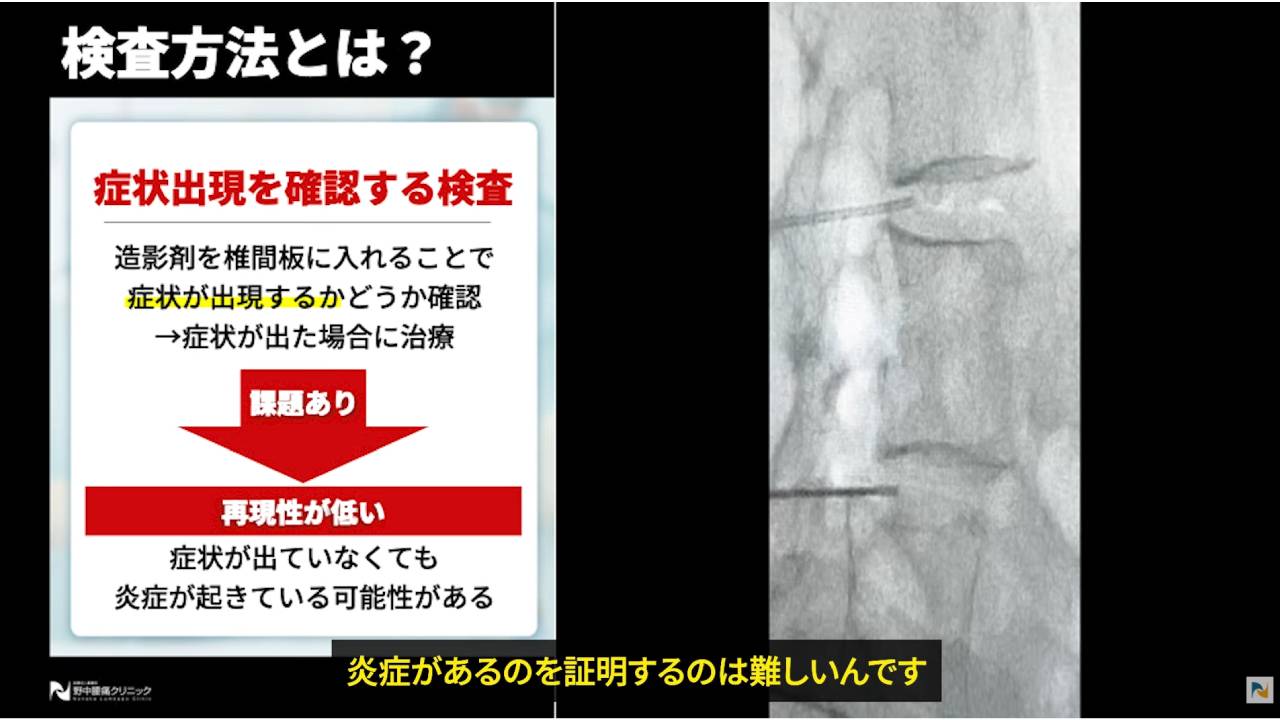 画像は造影剤検査の説明