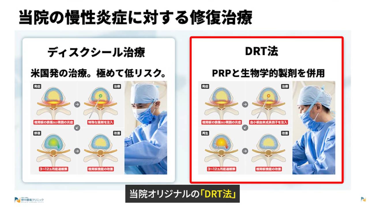 画像はDRT法の説明