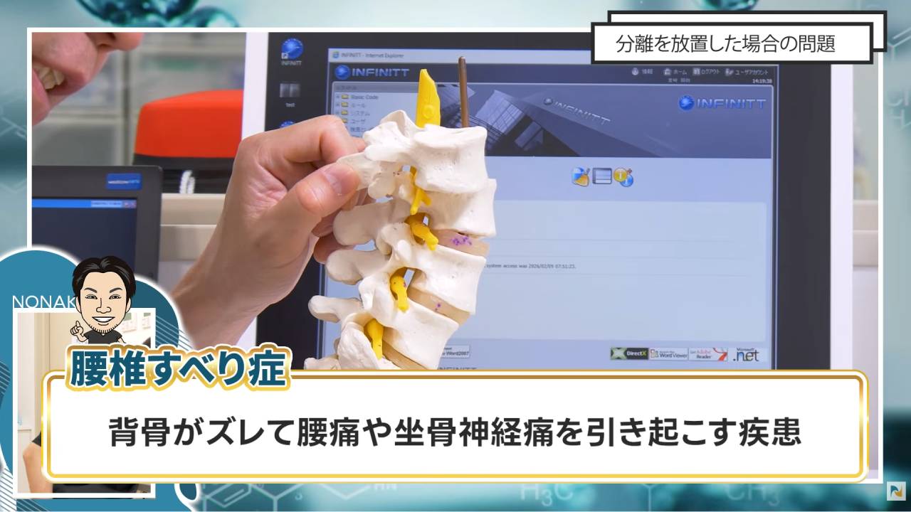 画像は腰椎すべり症の説明