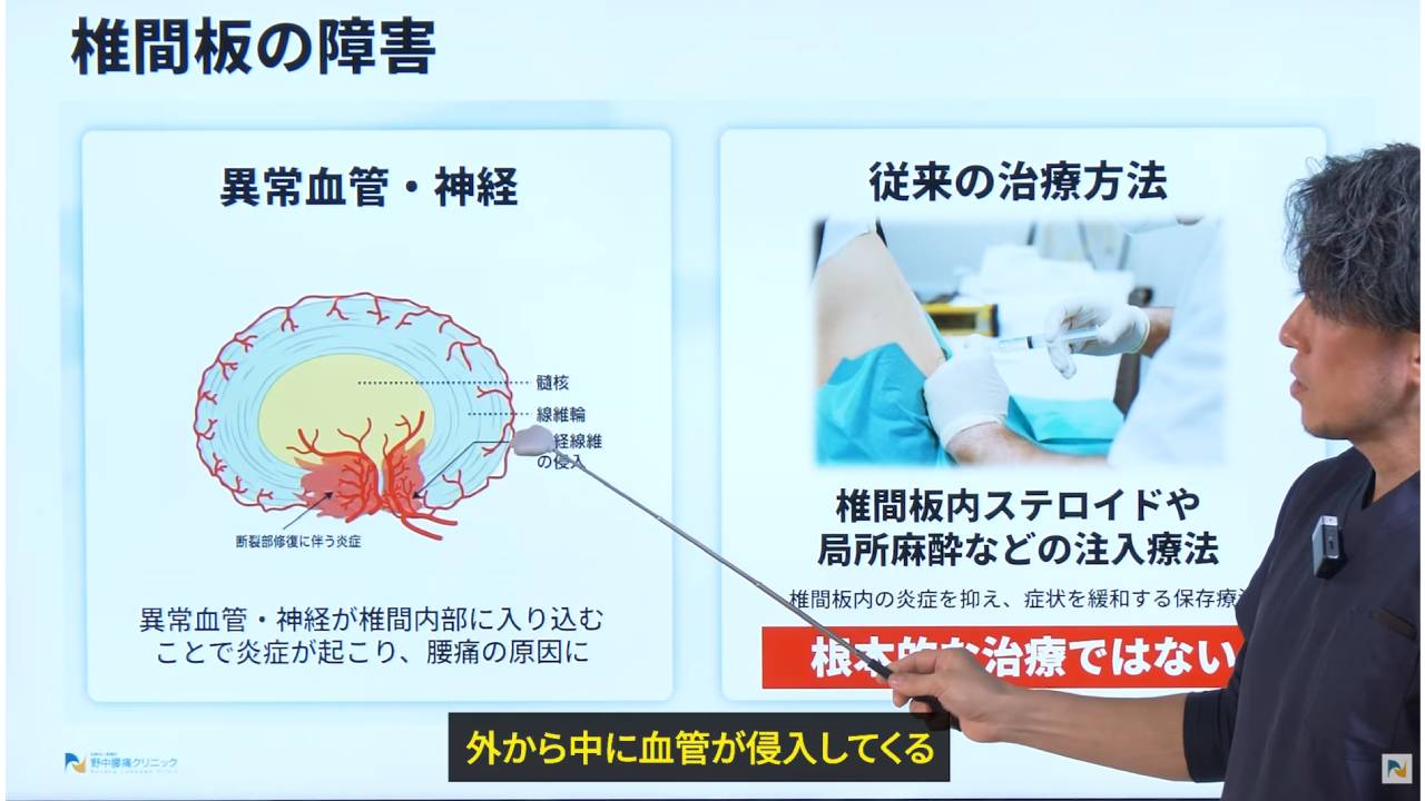 画像は血管の侵入