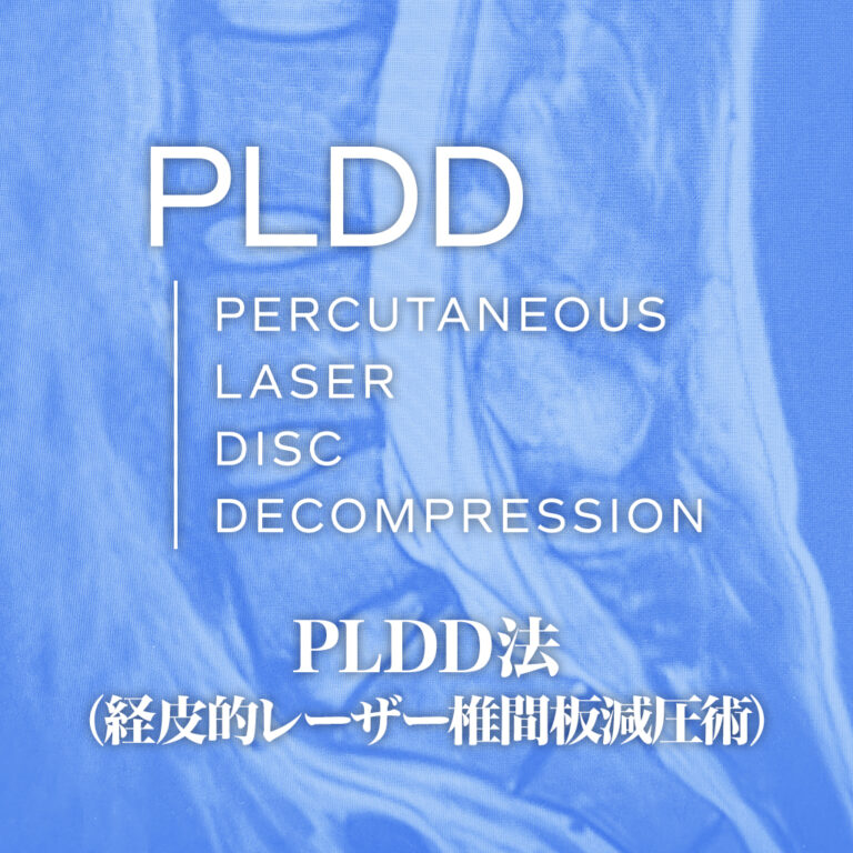 高校球児にPLDD（10代男性）