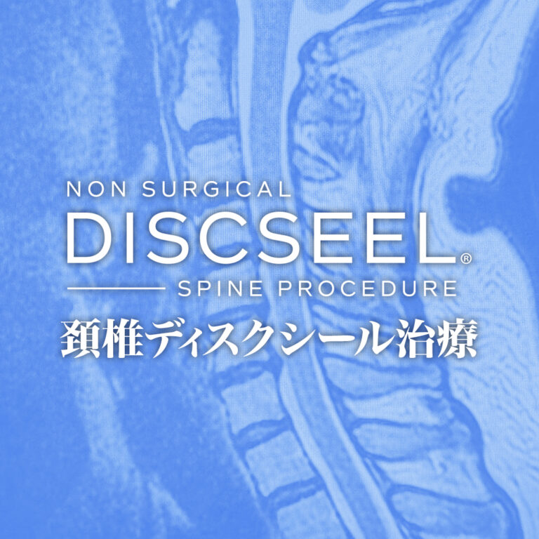 腰に続いて頚椎治療を(50代女性)