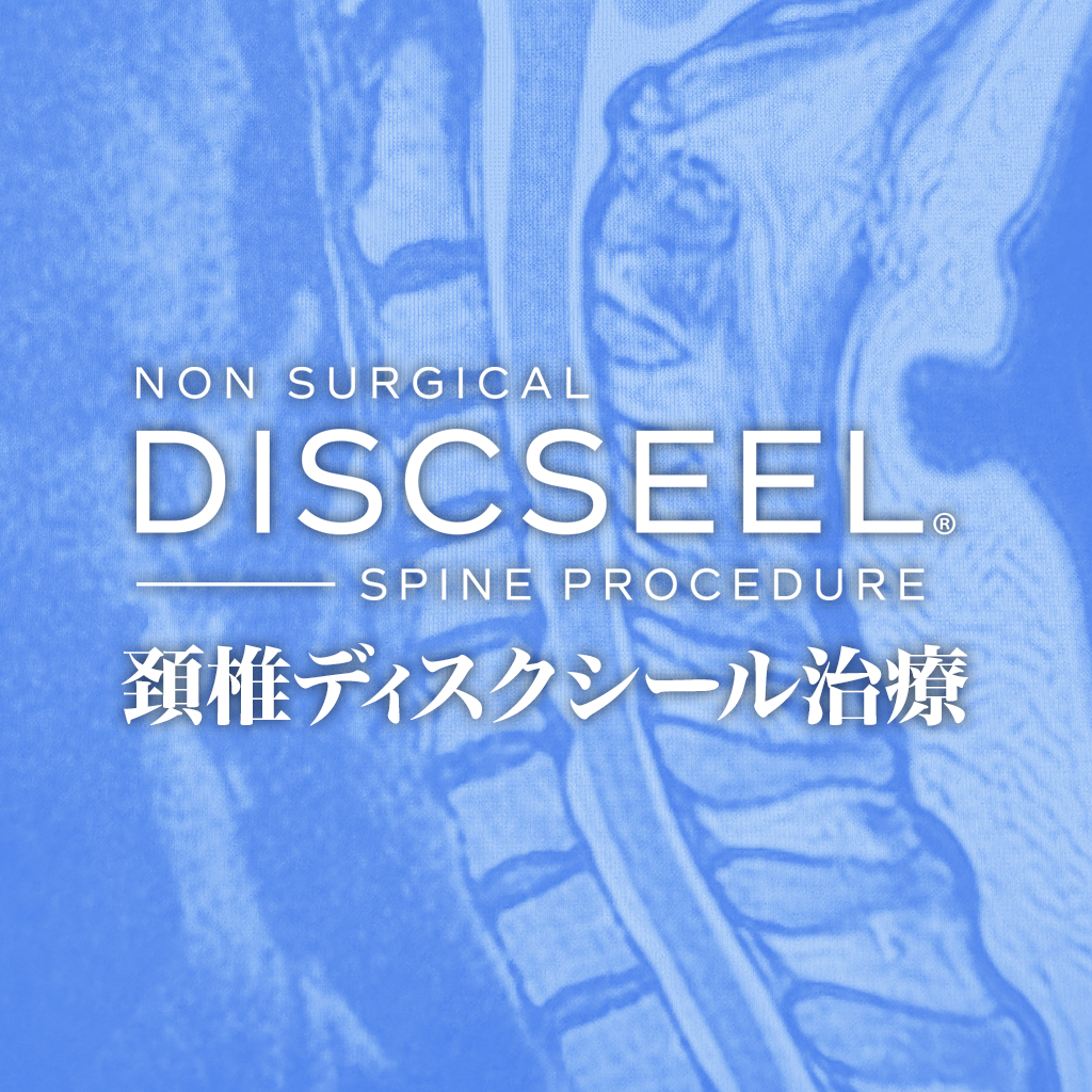 腰痛治療に続いて頚椎治療を希望された50代女性