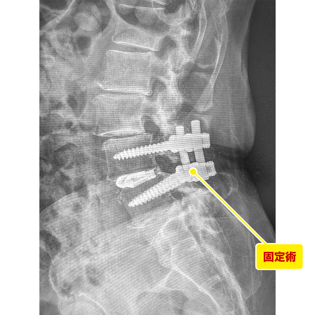 レントゲン検査