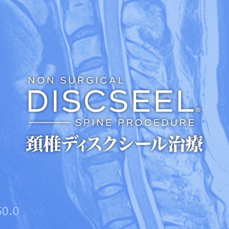 2度の頚椎除圧術後も残存する症状の改善を期待して