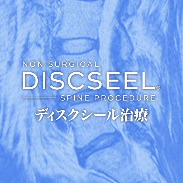 歩くのが苦痛の50代女性
