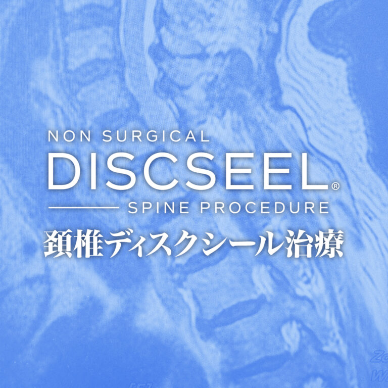 首が痛くて保存治療をするも改善のない50代女性