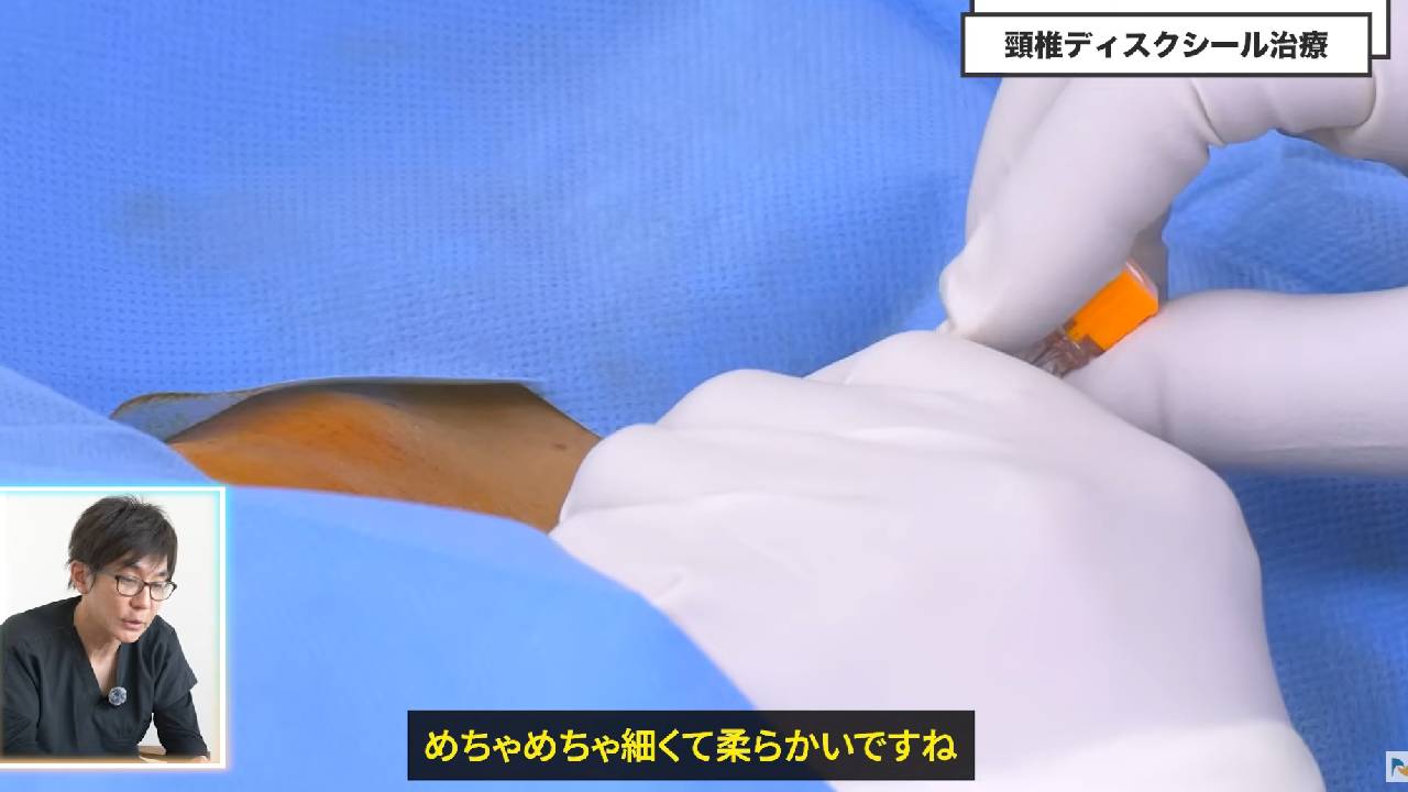 細くて柔らかい針