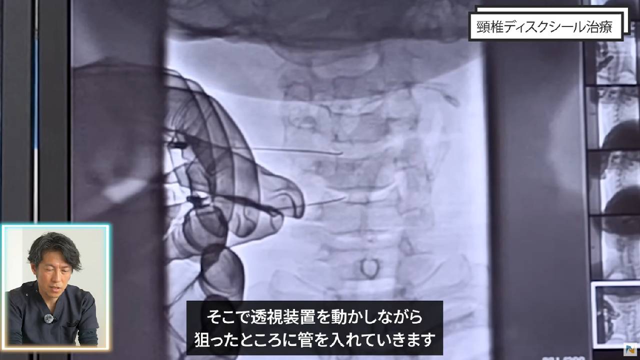 画像は透視装置
