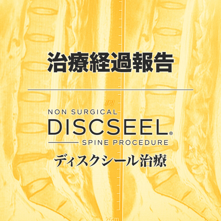 改善がほとんどないですけど……