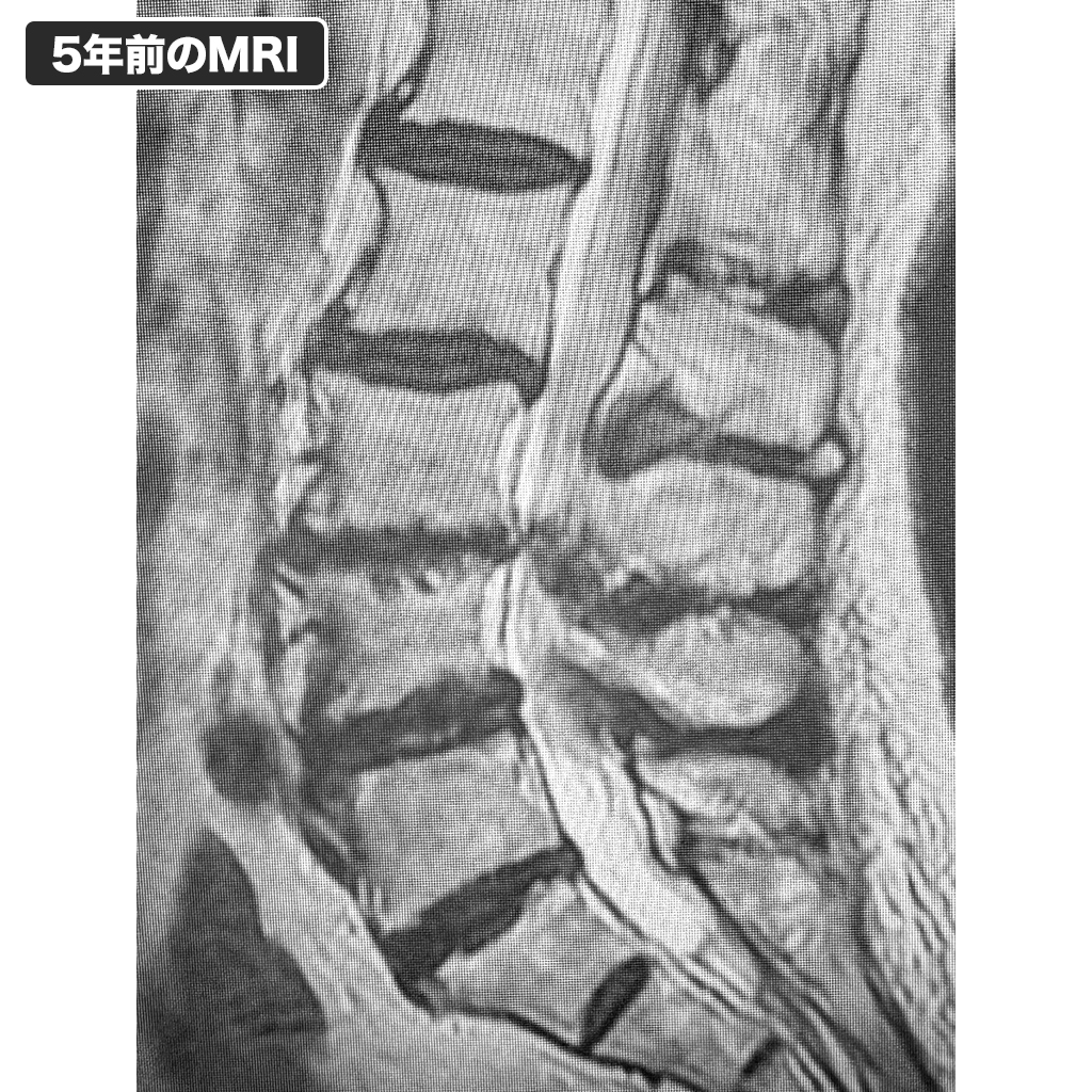 5年前のMRI