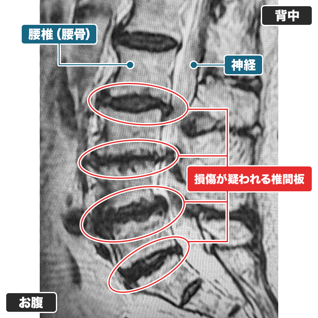 本日のMRI