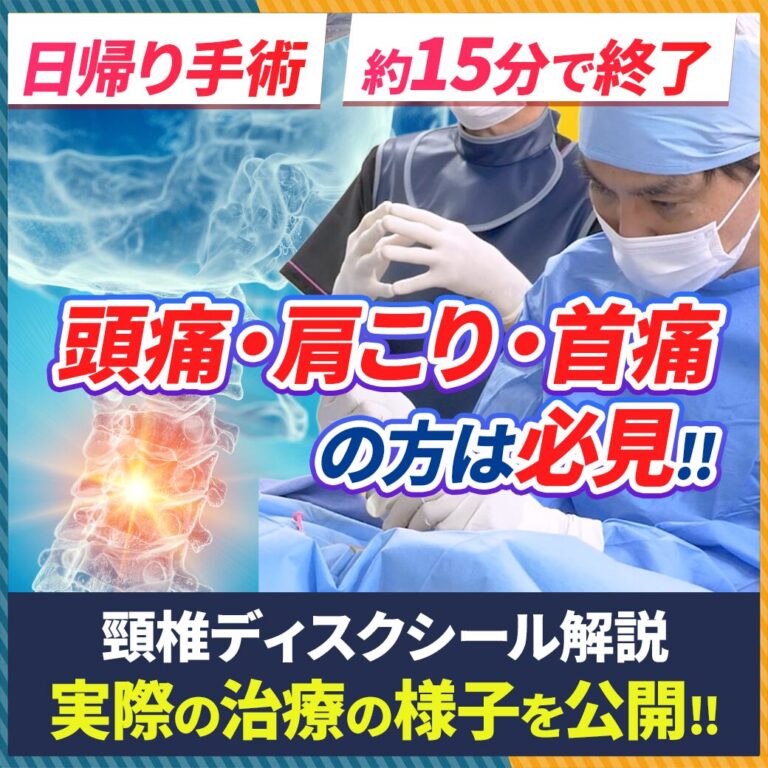 【日帰り頚椎治療】頭痛・首痛の新選択!「頚椎ディスクシール治療」の全貌を徹底解説