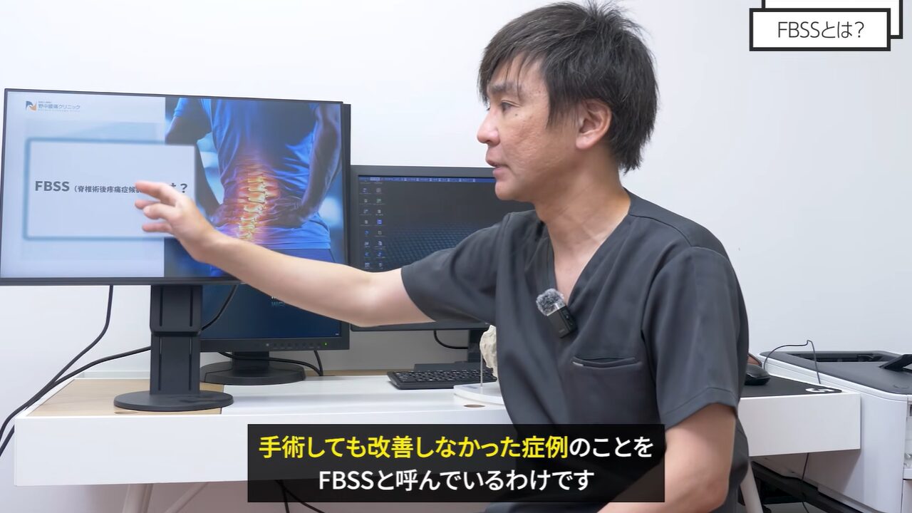 FBSSとは何か