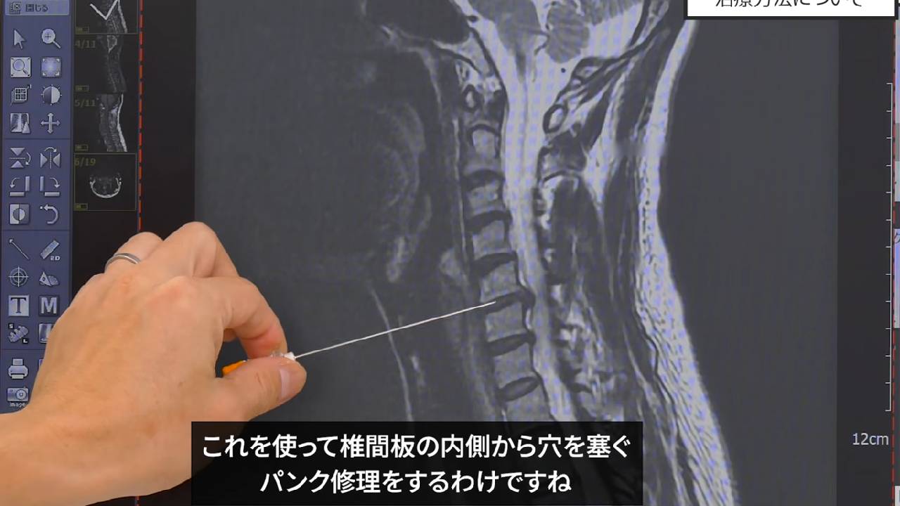 ディスクシールの説明