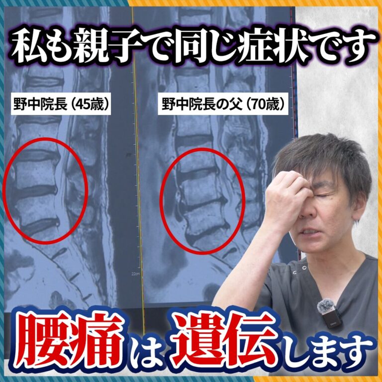 【親が腰痛なら自分も危ない?】腰痛の5割は遺伝という衝撃の事実と、今すぐできる対策法