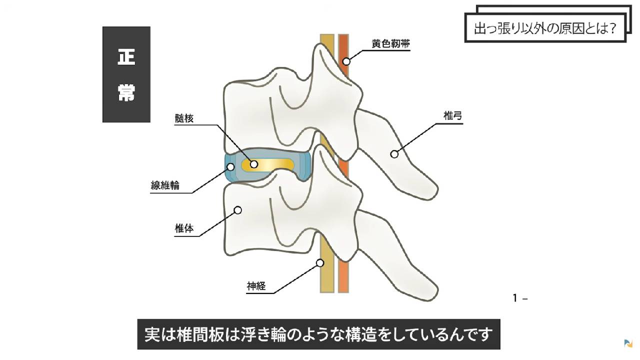 椎間板の説明