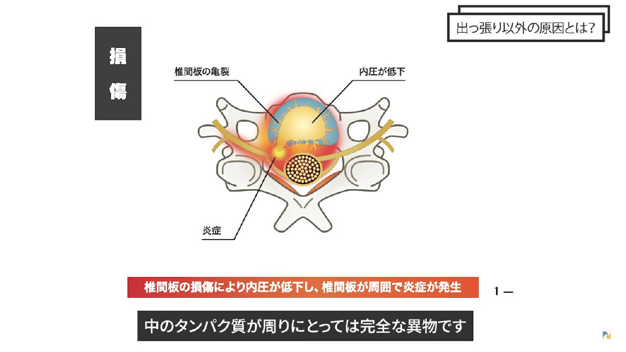 炎症の説明