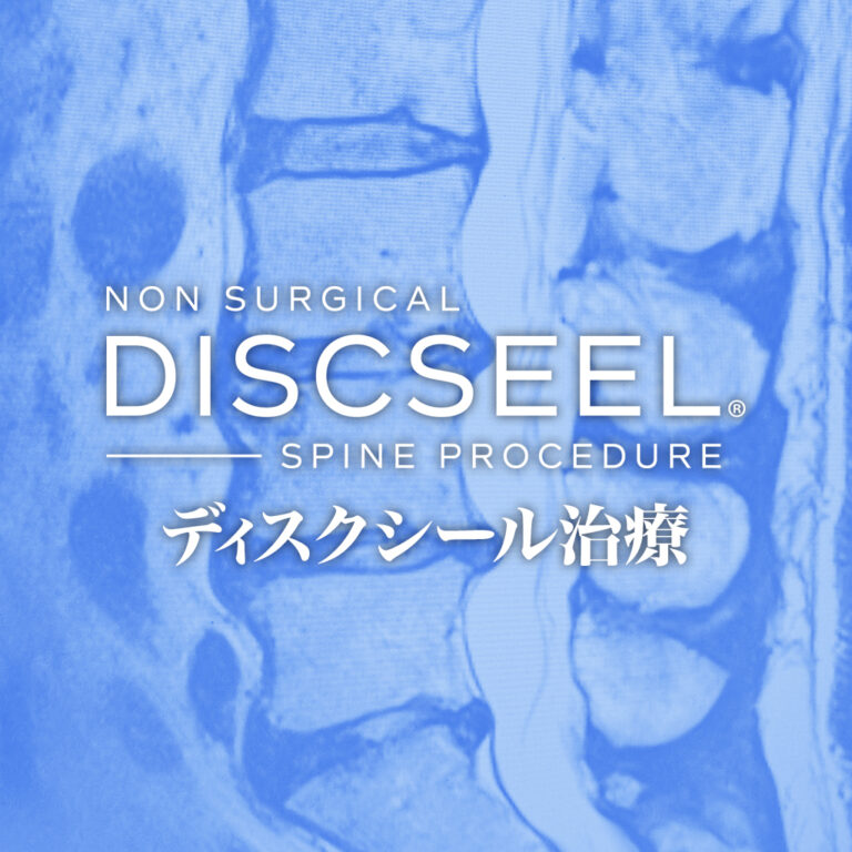 慢性腰痛を起こす椎間板の変性度合いはグレードIVの60代男性