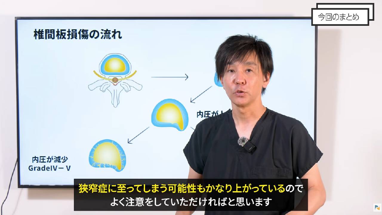 ヘルニアのまとめ